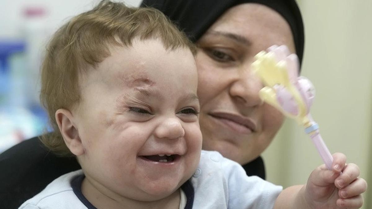 Cerita Bayi Mostafa Qadoura dari Gaza: Kehilangan Mata dan Sebagian Besar Keluarganya Akibat Serangan Israel